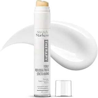 StretchMarkers Therapy Stretch Mark Cream – Visibly Reduces and Treats, Stretch Marks Removal with Retinol, Hyaluronic Acid, Bioactive Peptides & 3D Stem Cell Technology, 1 fl oz