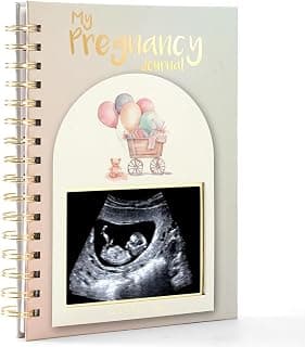 Pregnancy Must Haves Hardcover Keepsake Scrapbook With Notes, Photo Pockets & Detailed Prompts(Bear Pattern)
