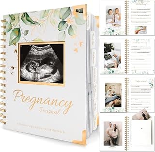 Upgrade Your Life With This: Pregnancy Journal for First Time Moms Gifts - 90 Pages Hardcover Pregnancy Memory Book, Beautiful & Cute Baby Book Keepsake, Ultrasound Baby Scrapbook, New Mom Gifts for Mother's Day (Alpine)